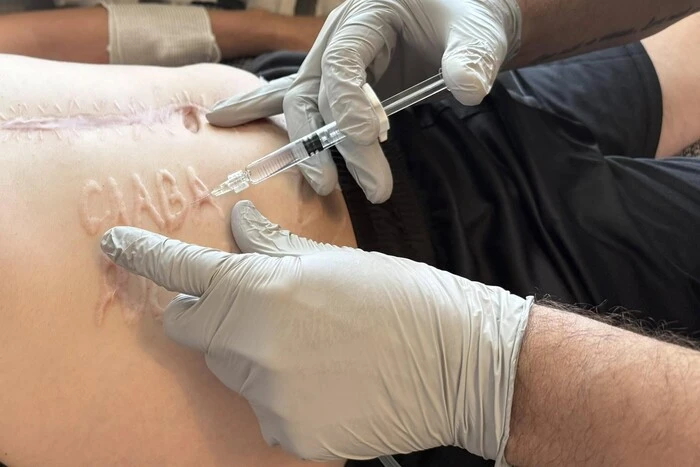 Doctors help the soldier get rid of the horrifying inscription made by the Russians on his body